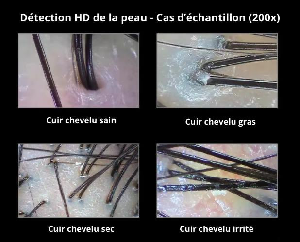 Analyseur numérique ( diagnostic)