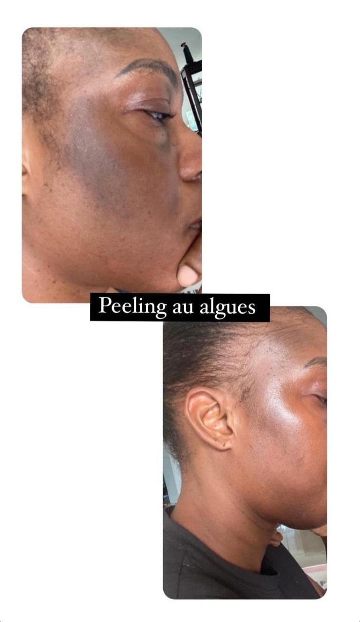 Formation Peeling aux algues verte